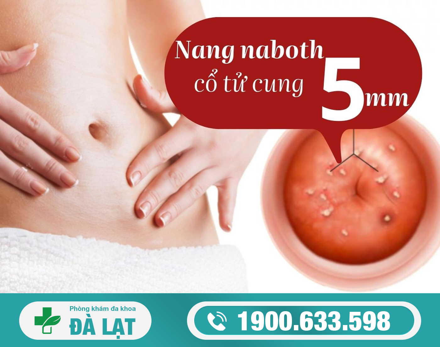 Hình ảnh minh họa